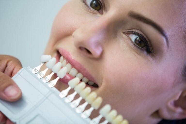 Mobile Teeth Whitening Services Serving Greater Toronto Area
