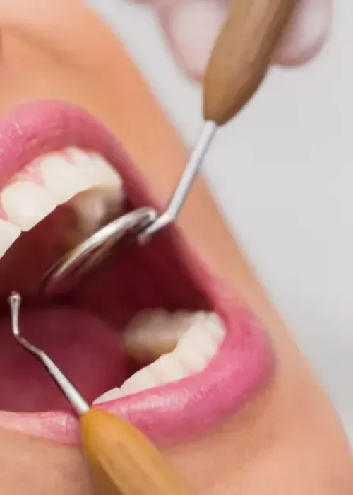 Dental Services Bowmanville